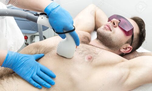 110530694-man-on-the-procedure-of-laser-hair-removal-in-the-beauty-salon GoldenOrchard